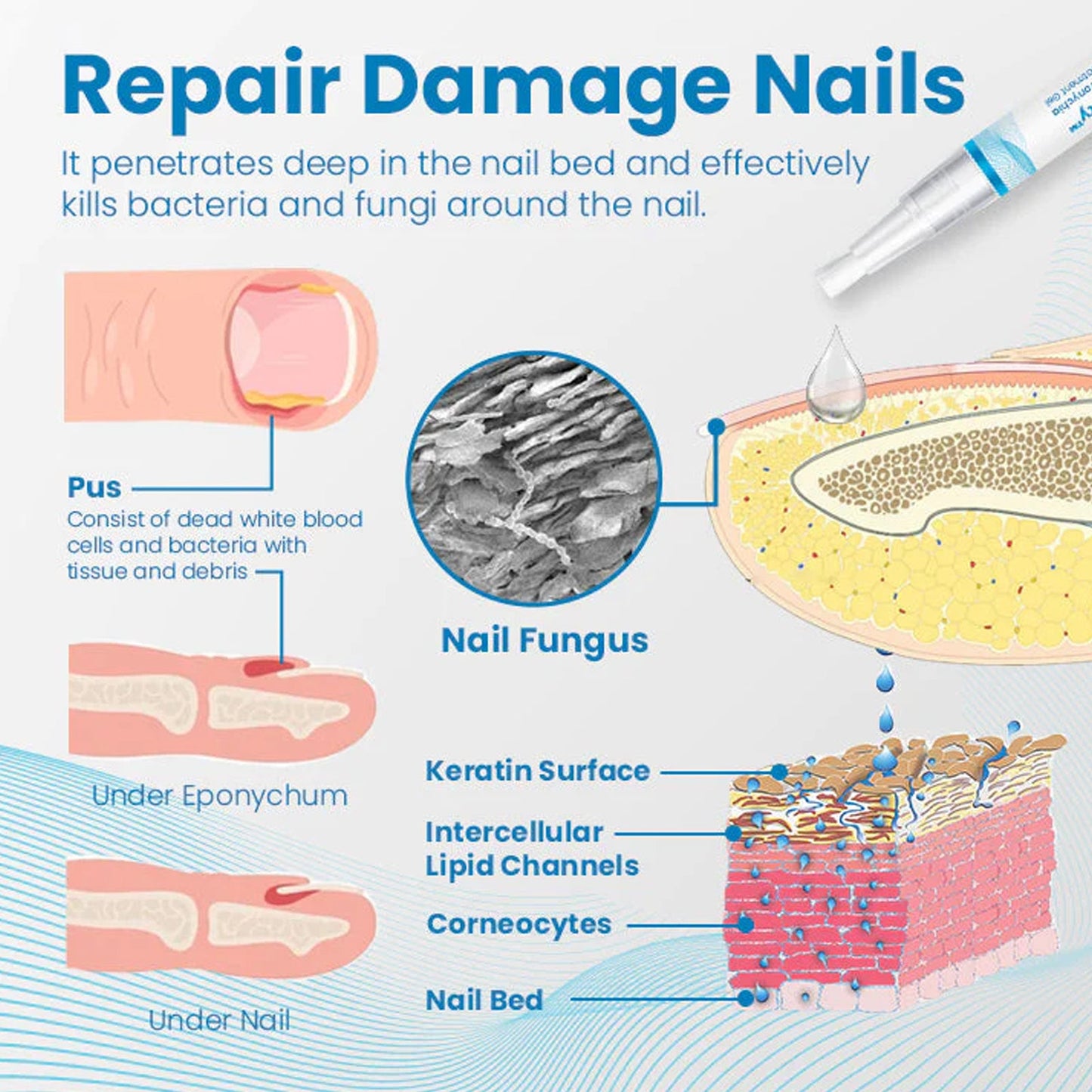 Anti-Paronychia Nail Repairing Gel, Repair Encased Rotten Nails Soft Nails Thickening Pain Relief Cleansing Care
