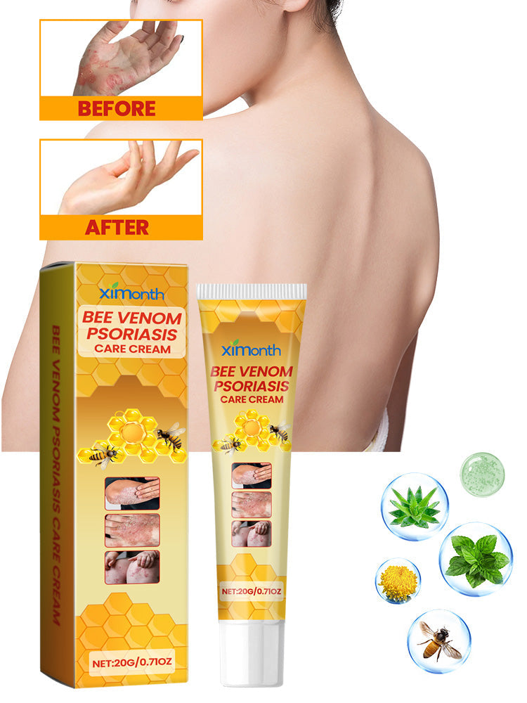 Bee-Poison Cowhide Moss Cream, Which Relieves Redness And Itchiness Of Skin