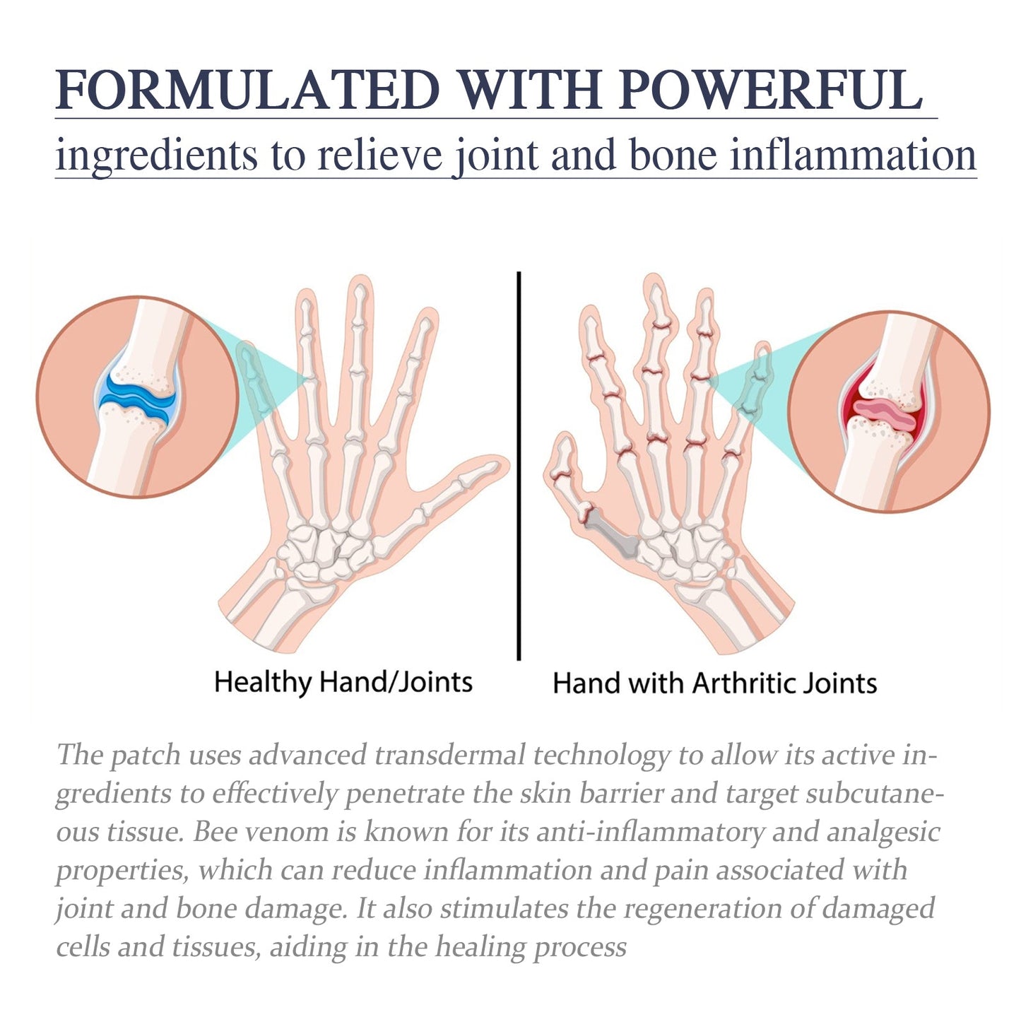 Bee Venom Joint Cream, Relieves Hands Legs Bones Knees Lumbar Spine Sedentary Joint Pain Body Care Cream